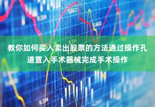 教你如何买入卖出股票的方法通过操作孔道置入手术器械完成手术操作